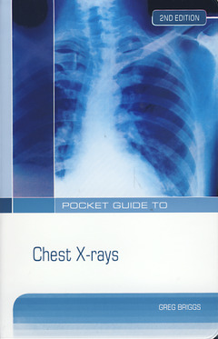 Cover of the book Pocket guide to chest X-rays