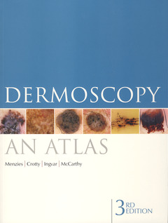 Couverture de l’ouvrage Dermoscopy: an atlas