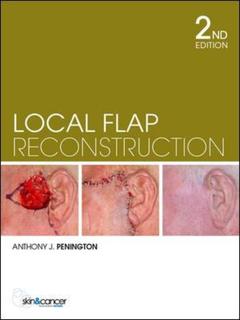 Cover of the book Local flap reconstruction