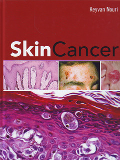 Cover of the book Skin cancer