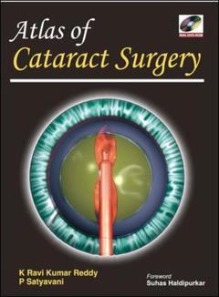 Couverture de l’ouvrage Atlas of cataract surgery (with DVD)