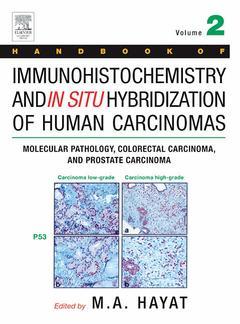 Couverture de l’ouvrage Handbook of Immunohistochemistry and in Situ Hybridization of Human Carcinomas