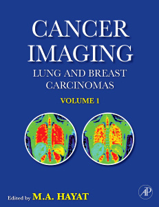 Cover of the book Cancer Imaging