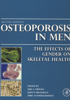 Couverture de l’ouvrage Osteoporosis in Men