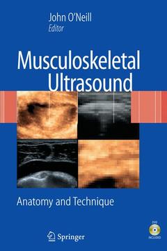Couverture de l’ouvrage Musculoskeletal ultrasound: anatomy and technique (with DVD)