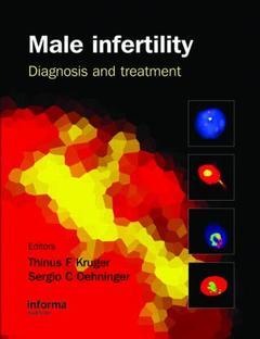 Cover of the book Male Infertility