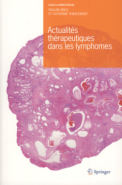 Couverture de l’ouvrage Actualités thérapeutiques dans les lymphomes