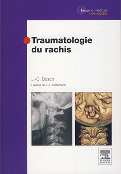 Couverture de l’ouvrage Traumatologie du rachis