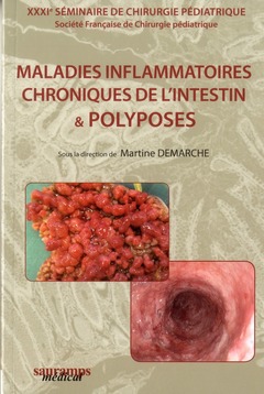 Couverture de l’ouvrage MALADIES INFLAMMATOIRES CHRONIQUES DE L'INTESTIN & POLYPOSES