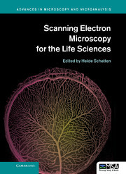 Couverture de l’ouvrage Scanning Electron Microscopy for the Life Sciences