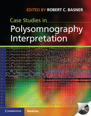 Couverture de l’ouvrage Case studies in polysomnography interpretation