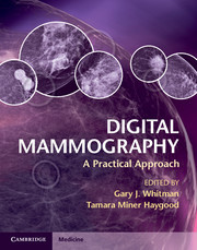 Couverture de l’ouvrage Digital Mammography