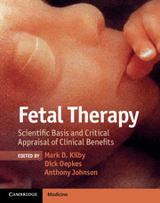 Couverture de l’ouvrage Fetal Therapy