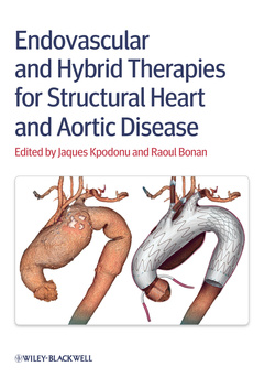 Couverture de l’ouvrage Endovascular and Hybrid Therapies for Structural Heart and Aortic Disease