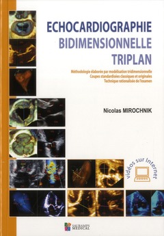 Cover of the book ECHOCARDIOGRAPHIE BIDIMENTIONNELLE TRIPLAN