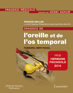 Cover of the book Imagerie de l'oreille et de l'os temporal