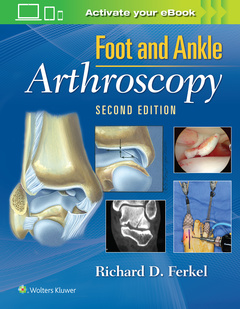 Couverture de l’ouvrage Foot & Ankle Arthroscopy