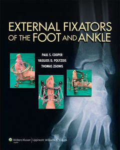 Couverture de l’ouvrage External Fixators of the Foot and Ankle