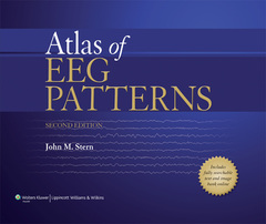 Couverture de l’ouvrage Atlas of EEG Patterns