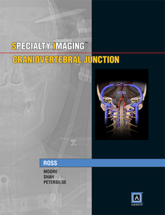 Couverture de l’ouvrage Specialty Imaging: Craniovertebral Junction