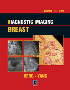 Couverture de l’ouvrage Diagnostic Imaging: Breast, 2nd ed