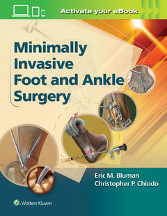 Couverture de l’ouvrage Minimally Invasive Foot & Ankle Surgery