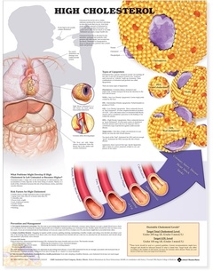 Cover of the book High Cholesterol Anatomical Chart