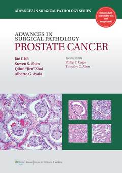 Couverture de l’ouvrage Advances in Surgical Pathology: Prostate Cancer