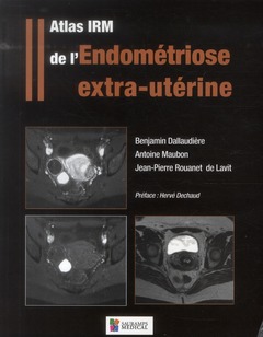 Couverture de l’ouvrage ATLAS IRM DE L'ENDOMETRIOSE EXTRA-UTERINE
