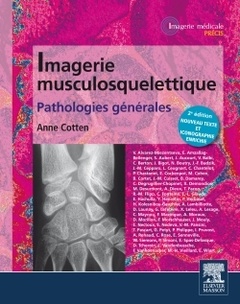 Couverture de l’ouvrage Imagerie musculosquelettique : pathologies générales