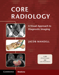 Couverture de l’ouvrage Core Radiology