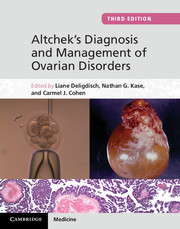 Couverture de l’ouvrage Altchek's Diagnosis and Management of Ovarian Disorders