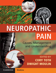 Couverture de l’ouvrage Neuropathic Pain
