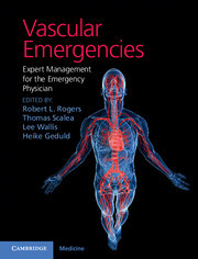 Cover of the book Vascular Emergencies