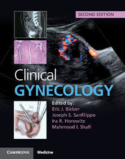 Couverture de l’ouvrage Clinical Gynecology
