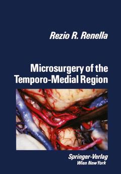 Couverture de l’ouvrage Microsurgery of the Temporo-Medial Region