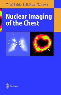 Couverture de l’ouvrage Nuclear Imaging of the Chest