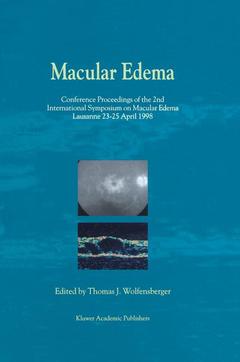 Couverture de l’ouvrage Macular Edema