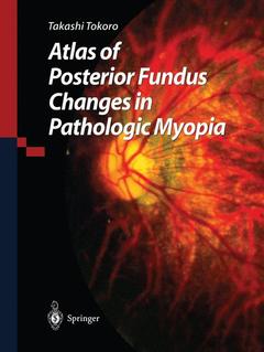 Couverture de l’ouvrage Atlas of Posterior Fundus Changes in Pathologic Myopia