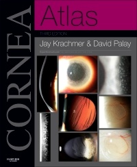 Couverture de l’ouvrage Cornea Atlas