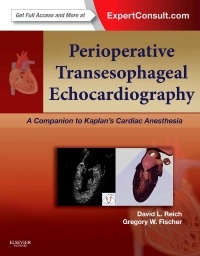Cover of the book Perioperative Transesophageal Echocardiography