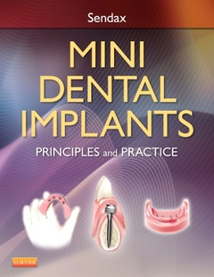 Couverture de l’ouvrage Mini Dental Implants