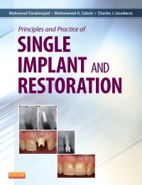 Couverture de l’ouvrage Principles and Practice of Single Implant and Restoration