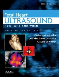 Couverture de l’ouvrage Fetal Heart Ultrasound