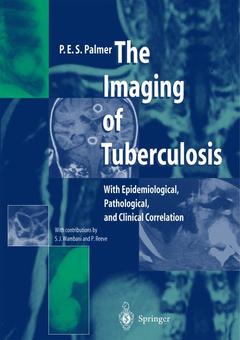 Couverture de l’ouvrage The Imaging of Tuberculosis