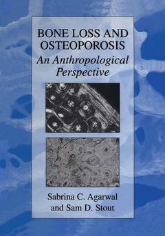 Couverture de l’ouvrage Bone Loss and Osteoporosis