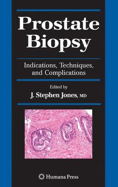 Couverture de l’ouvrage Prostate Biopsy