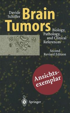 Cover of the book Brain Tumors