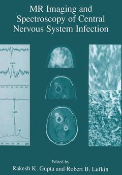 Couverture de l’ouvrage MR Imaging and Spectroscopy of Central Nervous System Infection