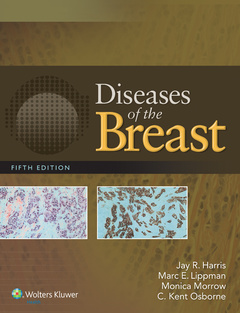 Couverture de l’ouvrage Diseases of the Breast 5e